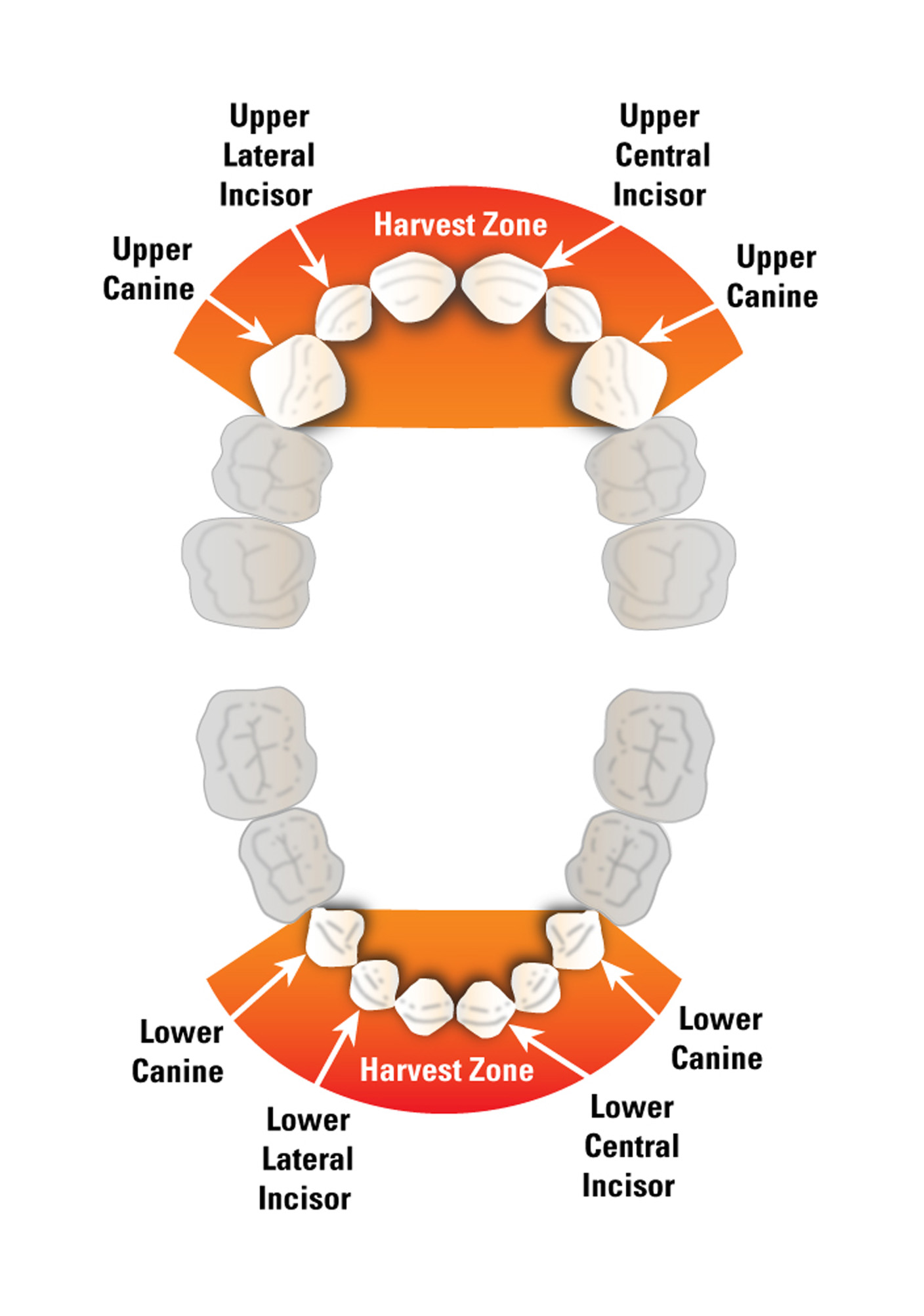 Tooth Eligibility Criteria - StemSave